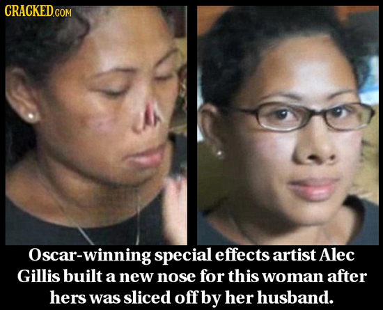 CRACKED.COM Oscar-winning special effects artist Alec Gillis built a new nose for this woman after hers was sliced off by her husband. 