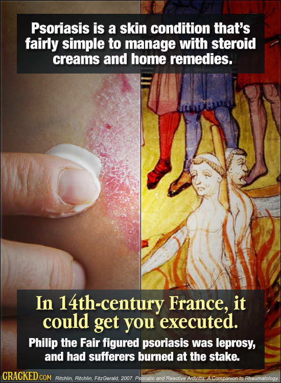 Psoriasis is a skin condition that's fairly simple to manage with steroid creams and home remedies. In 14th-century France, it could get you executed.