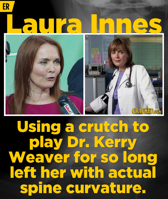 20 Actors Who Jacked Their Bodies Around For Iconic Roles