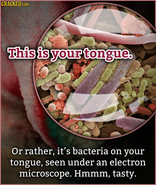 CRACKED COM This is your tongue. Or rather, it's bacteria on your tongue, seen under an electron microscope. Hmmm, tasty.