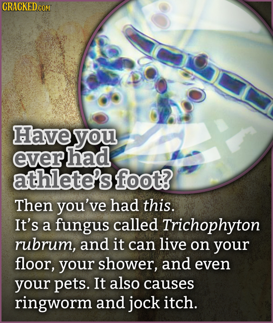 CRACKED COM Have you ever had athlete's foot? Then you've had this. It's a fungus called Trichophyton rubrum, and it can live on your floor, your show