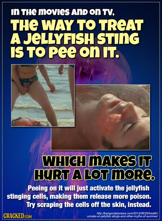 In THE movies AND on TV, THE WAY TO TREAT AJELLYFISH STING IS TO Pee on IT. WHICH MAKES IT HURT A LOT moreo Peeing on it will just activate the jellyf