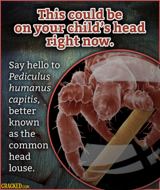 This could be on your child's head right nowo Say hello to Pediculus humanus capitis, better known as the common head louse. CRACKED COM 