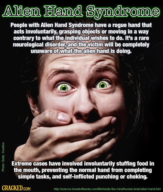 Alien Hand Syndrome People with Alien Hand Syndrome have a rogue hand that acts involuntarily, grasping objects or moving in a way contrary to what th