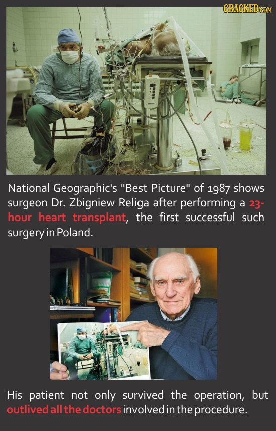 National Geographic's Best Picture of 1987 shows surgeon Dr. Zbigniew Religa after performing a 23- hour heart transplant, the first successful such