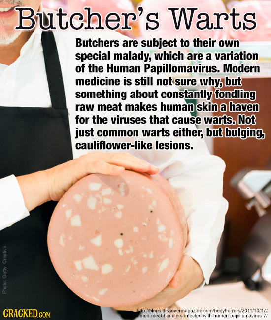 Butcher's Warts Butchers are subject to their own special malady, which are a variation of the Human Papillomavirus. Modern medicine is still not sure