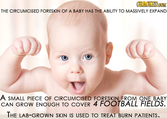 CRACKEDOON THE CIRCUMCISED FORESKIN OF A BABY HAS THE ABILITY TO MASSIVELY EXPAND A SMALL PIECE OF CIRCUMCISED FORESKIN FROM ONE BABY CAN GROW ENOUGH