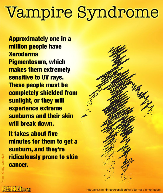 Vampire Syndrome Approximately one in a million people have Xeroderma Pigmentosum, which makes them extremely rlrrhwe sensitive to UV rays. These peop