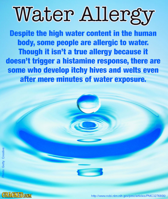 Water Allergy Despite the high water content in the human body, some people are allergic to water. Though it isn't a true allergy because it doesn't t