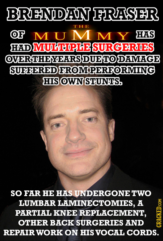 BRENDAN FRASER THE OF MUMMY HAS HAD MULTIPLE SURGERIES OVERTHEYEARSI DUETO DAMAGE SUFFERED FROM PERFORMING HIS OWN STUNTS. SO FAR HE HAS UNDERGONE' TW