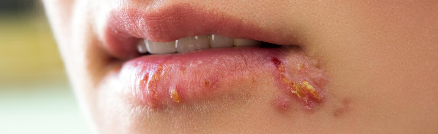 22 Diseases That Are Way Weirder Than You Realize