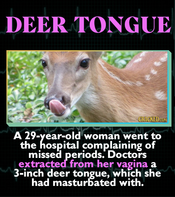 15 Horrifying Ways Sex Can Go Wrong - A 29-year-old woman went to the hospital complaining of missed periods. Doctors extracted from her vagina a 3-in