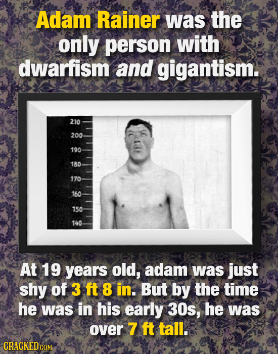 Adam Rainer Was the only person with dwarfism and gigantism. 210 200 190 180 170 160 150 140 At 19 years old, adam was just shy of 3 ft 8 in. But by t