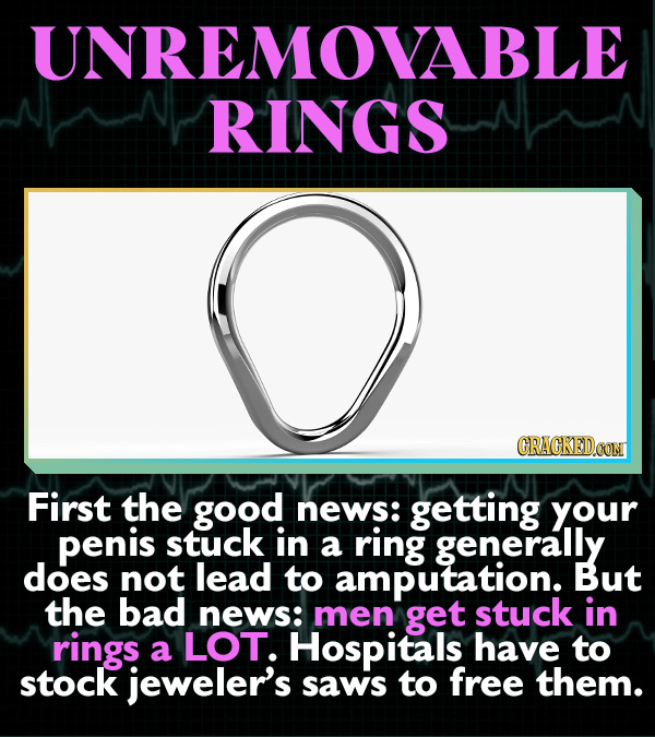 15 Horrifying Ways Sex Can Go Wrong - First the good news: getting your penis stuck in a ring generally does not lead to amputation. But the bad news: