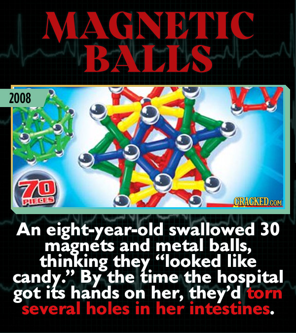 15 Weird Cases That Walked Into Doctors' Operating Rooms - An eight-year-old swallowed 30 magnets and metal balls, thinking they “looked like candy.”