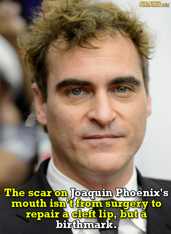 CRACKEDOON The scar on Joaquin Phoenix's mouth isn't from surgery to repair a cleft lip, but a birthmark. 