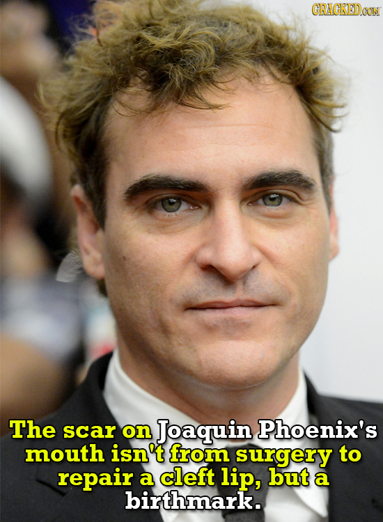 CRACKEDOON The scar on Joaquin Phoenix's mouth isn't from surgery to repair a cleft lip, but a birthmark.