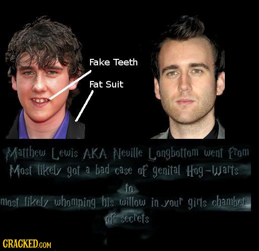 Fake Teeth Fat Suit Matthew Lewis AKA Neuille Longbottom went From Most likely got a bad case of genital Hog-wamts to most likely whomping his willous