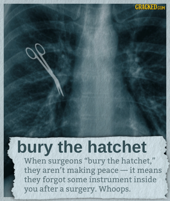 CRACKED COM bury the hatchet When surgeons bury the hatchet, they aren't making peace - it means they forgot some instrument inside you after a surg