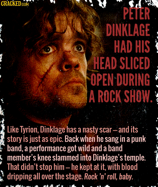 PETER DINKLAGE HAD HIS HEAD SLICED OPEN-DURING A ROCK SHOW. Like Tyrion, Dinklage has a nasty scar-and its story is just as epic. Back when he sang in