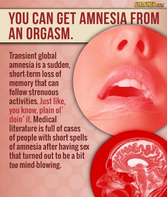 CRACKEDCOT YOU CAN GET AMNESIA FROM AN ORGASM. Transient global amnesia is a sudden, short-term loss of memory that can follow strenuous activities. J