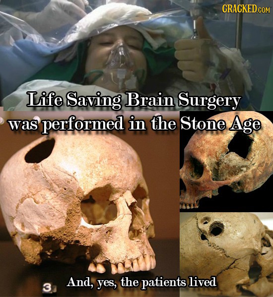 CRACKED co Life Saving Brain Surgery was performed in the Stone Age And, yes, the patients lived 3
