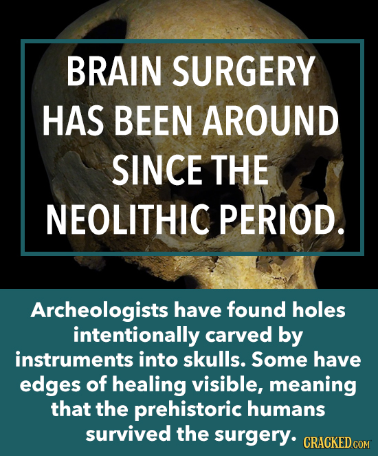 BRAIN SURGERY HAS BEEN AROUND SINCE THE NEOLITHIC PERIOD. Archeologists have found holes intentionally carved by instruments into skulls. Some have ed