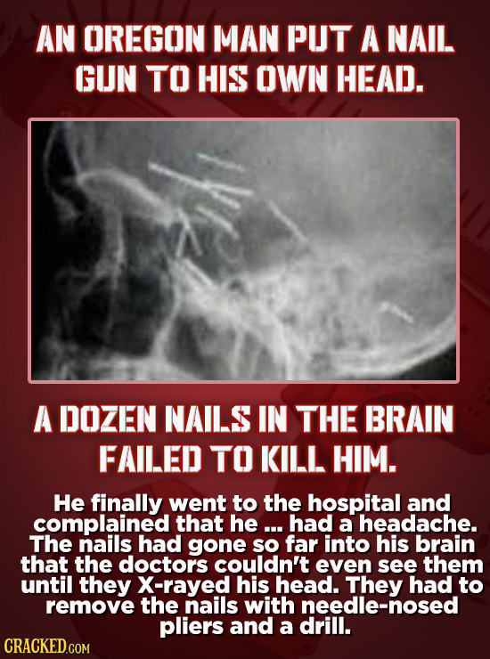 AN OREGON MAN PUT A NAIL GUN TO HIS OWN HEAD. A DOZEN NAILS IN THE BRAIN FAILED TO KILL HIM. He finally went to the hospital and complained that he ..