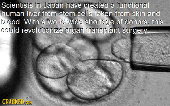 Scientists in Japan have created a functional human liver from stem cells taken from skin and bolood. With a world wide shortage of donors, this could