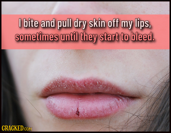 I bite and pull dry skin off my lips, sometimes until they start to bleed. CRACKED.CON 