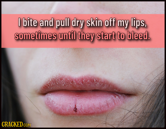 I bite and pull dry skin off my lips, sometimes until they start to bleed. CRACKED.CON