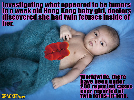 Investigating what appeared to be tumors in a week old Hong Kong baby girl, doctors discovered she had twin fetuses inside of her. Worldwide, there ha