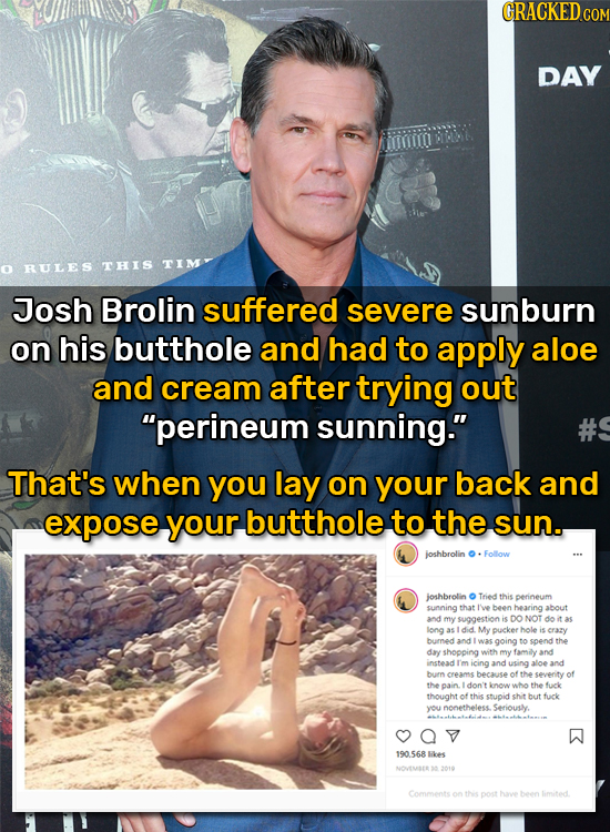 GRACKEDco DAY RULES THIS TIM Josh Brolin suffered severe sunburn on his butthole and had to apply aloe and cream after trying out perineum sunning.