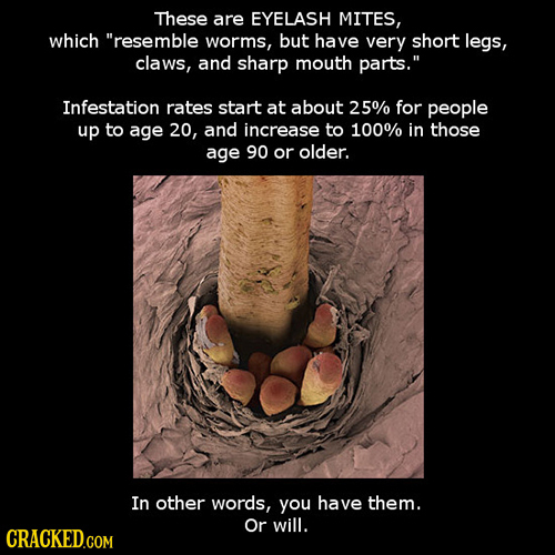 These are EYELASH MITES, which resemble worms, but have very shoRT legs, claws, and sharp mouth parts. Infestation rates start at about 25% for peop