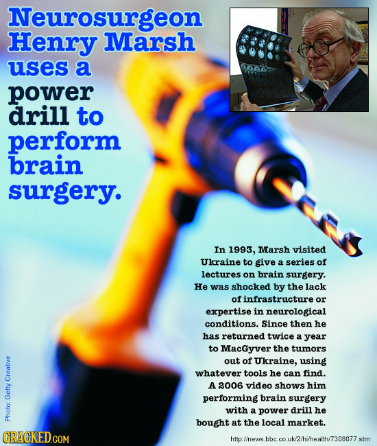 Neurosurgeon Henry Marsh uses a na power drill to perform brain surgery. In 1993, Marsh visited Ukraine to give a series of lectures on brain surgery.