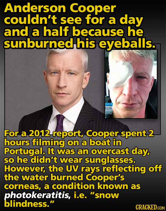 Anderson Cooper couldn't see for a day and a half because he sunburned his eyeballs. RSON LIVE For a 2012 report, Cooper spent 2 hours filming on a bo