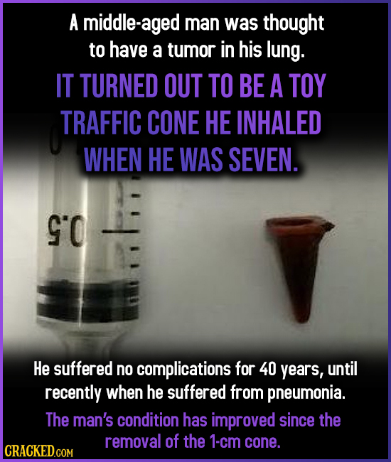 A middle-aged man was thought to have a tumor in his lung. IT TURNED OUT TO BE A TOY TRAFFIC CONE HE INHALED WHEN HE WAS SEVEN. S'O He suffered no com