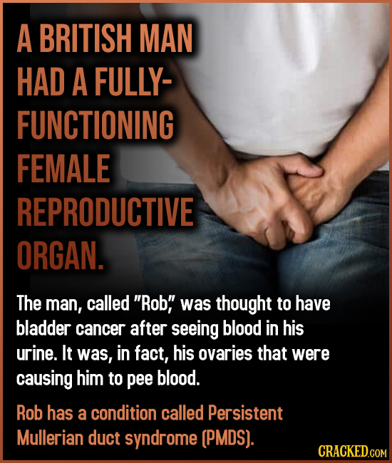 A BRITISH MAN HAD A FULLY- FUNCTIONING FEMALE REPRODUCTIVE ORGAN. The man, called Rob was thought to have bladder cancer after seeing blood in his u