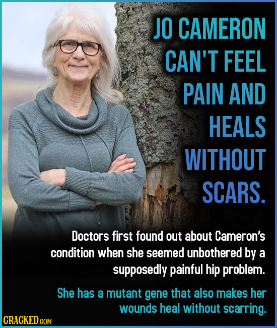 JO CAMERON CAN'T FEEL PAIN AND HEALS WITHOUT SCARS. Doctors first found out about Cameron's condition when she seemed unbothered by a supposedly painf
