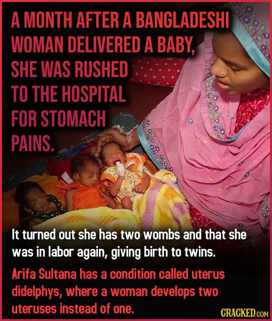 A MONTH AFTER A BANGLADESHI WOMAN DELIVERED A BABY, SHE WAS RUSHED TO THE HOSPITAL FOR STOMACH PAINS. It turned out she has two wombs and that she was