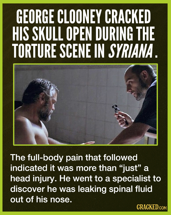 GEORGE CLOONEY CRACKED HIS SKULL OPEN DURING THE TORTURE SCENE IN SYRIANA. The full-body pain that followed indicated it was more than just a head i