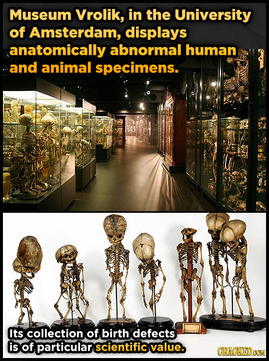 Museum Vrolik, in the University of Amsterdam, displays anatomically abnormal human and animal specimens. Its collection of birth defects is of partic