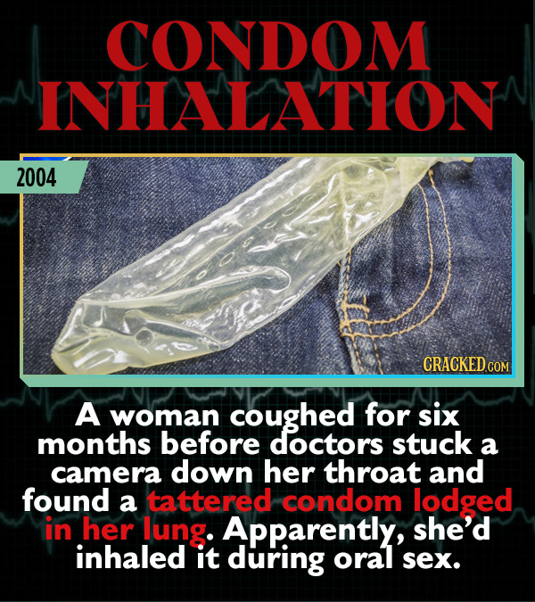 15 Weird Cases That Walked Into Doctors' Operating Rooms - A woman coughed for six months before doctors stuck a camera down her throat and found a ta