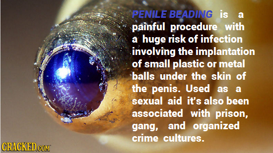 PENILE BEADING is a painful procedure with a huge risk of infection involving the implantation of small plastic or metal balls under the skin of the p