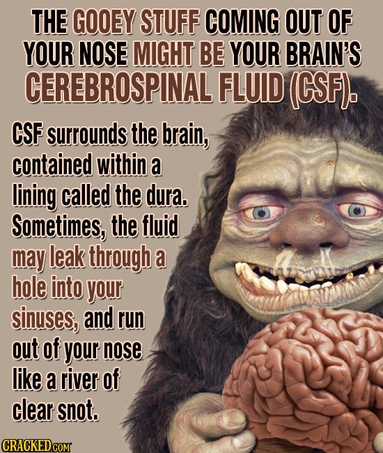 THE GOOEY STUFF COMING OUT OF YOUR NOSE MIGHT BE YOUR BRAIN'S CEREBROSPINAL FLUID (CSF). CSF surrounds the brain, contained within a lining called the