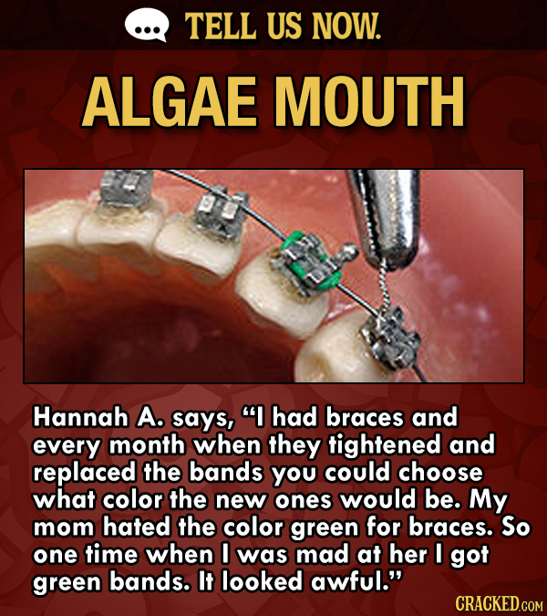 TELL US NOW. ALGAE MOUTH us Hannah A. says, I had braces and every month when they tightened and replaced the bands you could choose what color the n