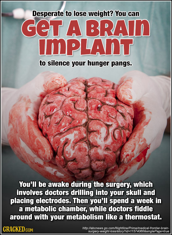 Desperate to lose weight? You can GET A BRAIn ImPLAnt to silence your hunger pangs. You'll be awake during the surgery, which involves doctors drillin