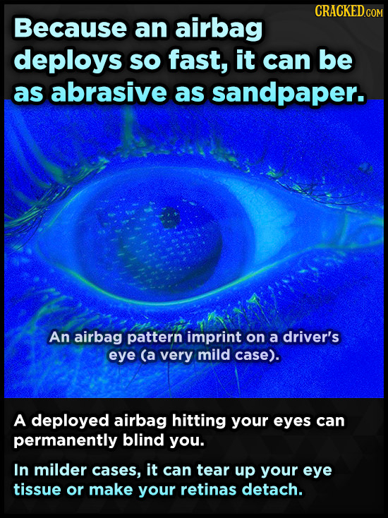 Because an airbag deploys sO fast, it can be as abrasive as sandpaper. An airbag pattern imprint on a driver's eye (a very mild case). A deployed airb
