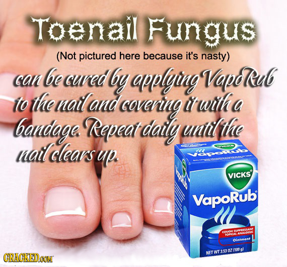Toenail Fungus (Not pictured here because it's nasty) be can cuved by applying VapdRub to the natland covening it wtth a bandage. Repeat daily untlthe