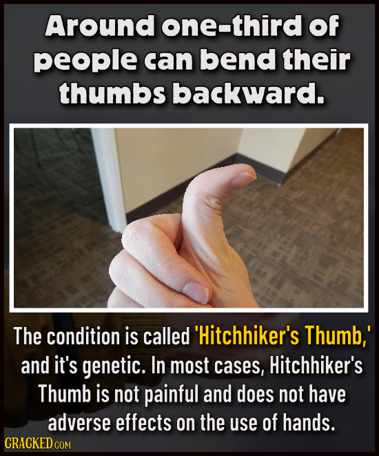 Around one-third Of people can bend their thumbs backward. The condition is called 'Hitchhiker's Thumb,' and it's genetic. In most cases, Hitchhiker's